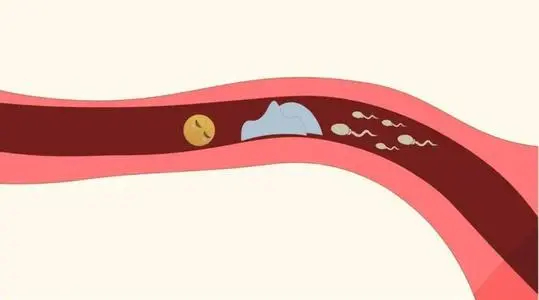 输卵管堵塞自查方法是什么？医生告诉你输卵管堵塞症状