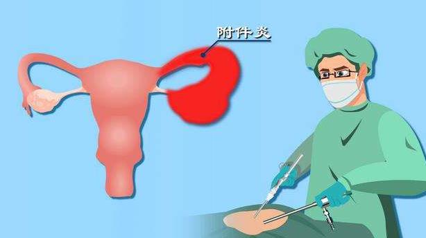 输卵管炎需要如何进行预防？输卵管炎症会不会导致不孕？