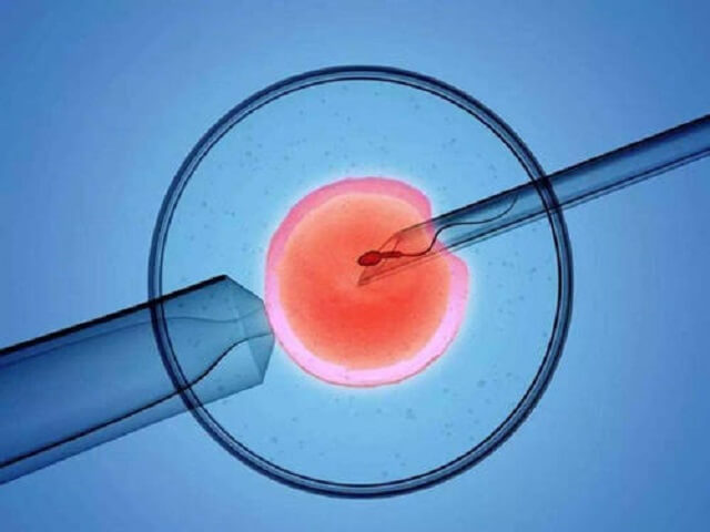 未婚女性在精子库申请精子需要什么条件 