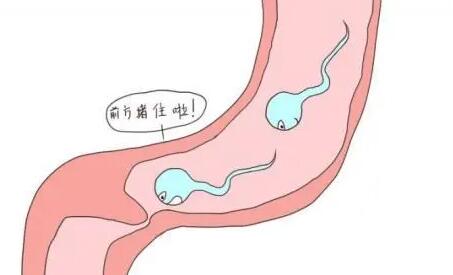 输卵管梗阻能试管怀孕吗成功率多少？
