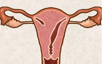 残角子宫可以正常怀孕吗能做试管吗多少钱？